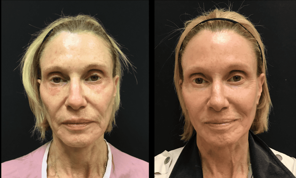 The Science of Collagen: How to Keep Your Skin Firm and Youthful ...